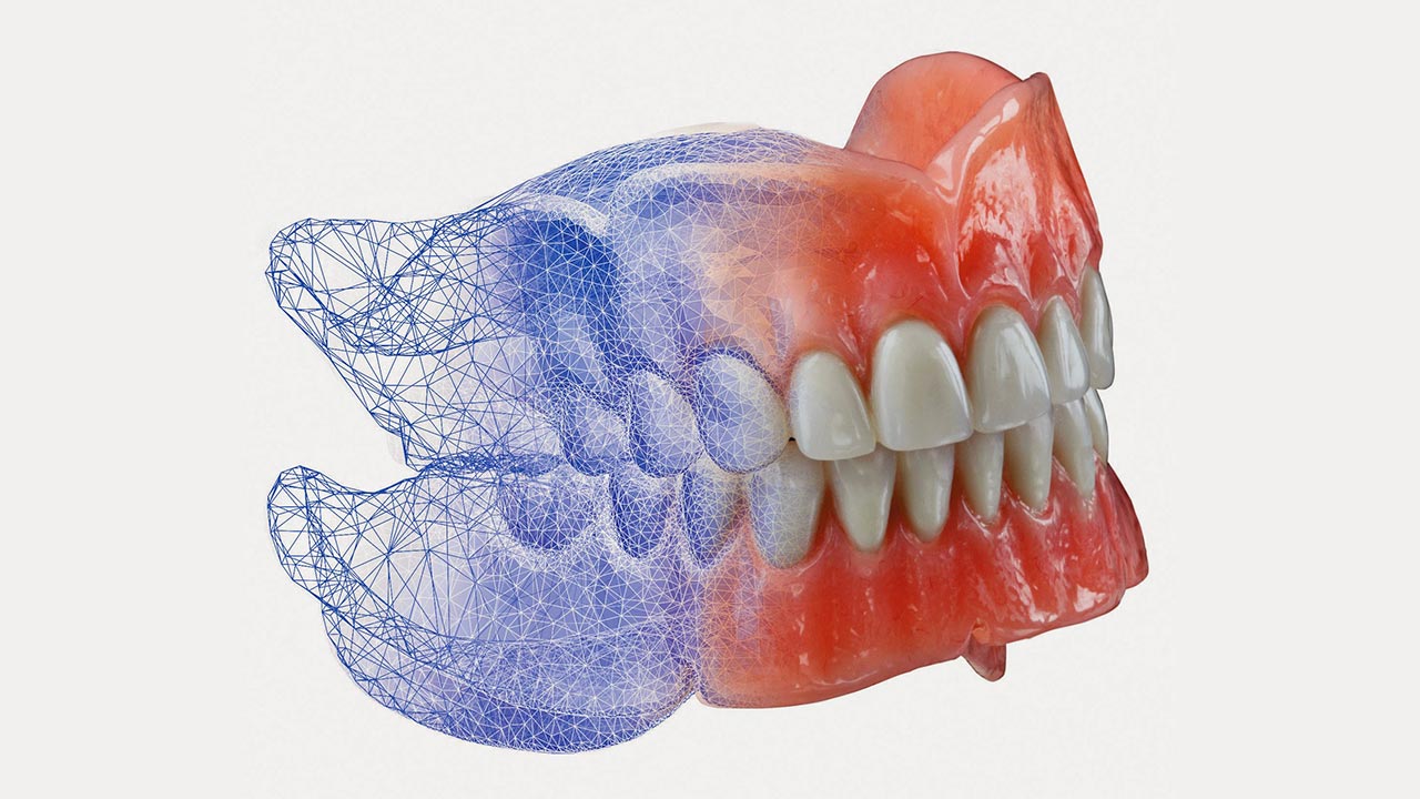 Full Dentures Diamond Denture Studio